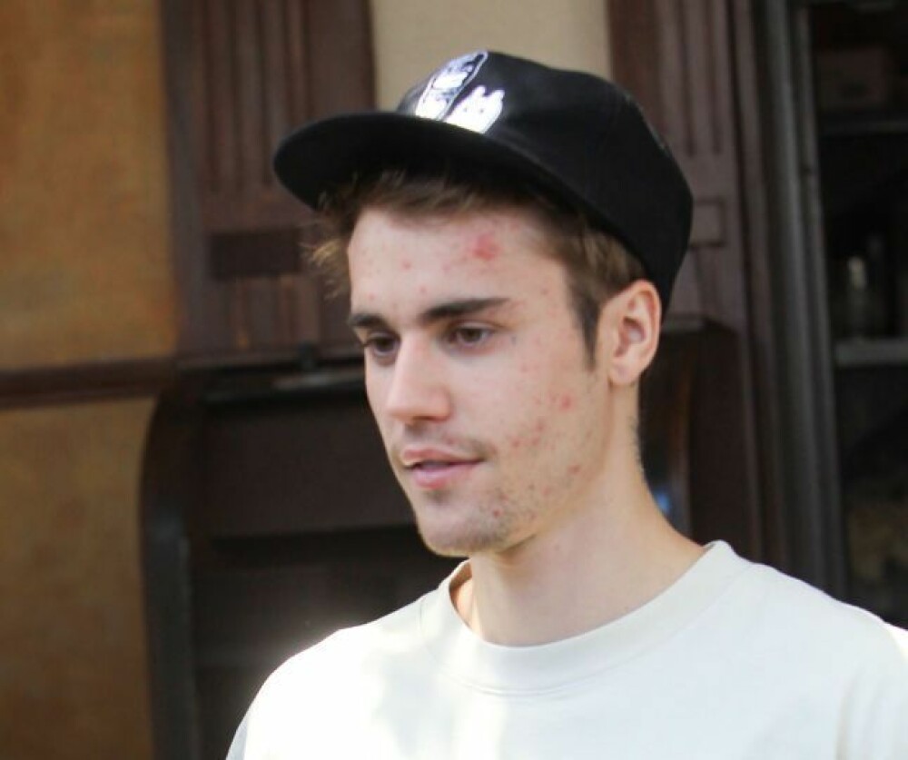 Transformarea lui Justin Bieber: cum arată la jumătate de an după ce a dezvăluit că suferă de boala Lyme - Imaginea 1