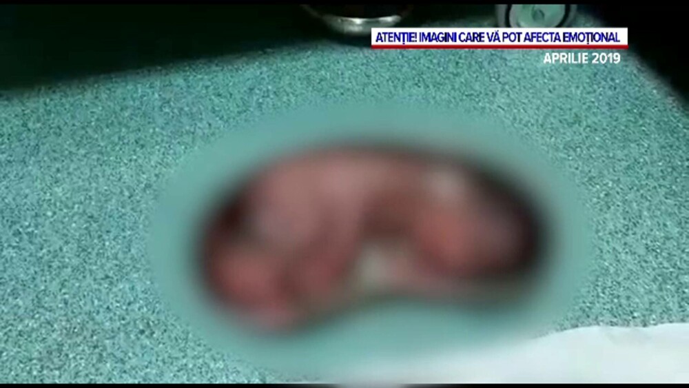 Doctorul de la Polizu care a lăsat un bebeluș 12 ore pe o tavă și într-un sac legat, după naștere, e deranjat de acuzații - Imaginea 3