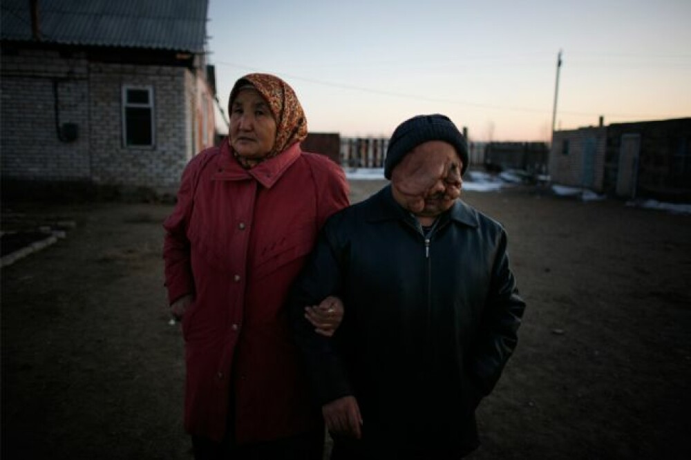 FOTOGRAFII DRAMATICE! Consecintele radiatiilor in Kazahstan! - Imaginea 12