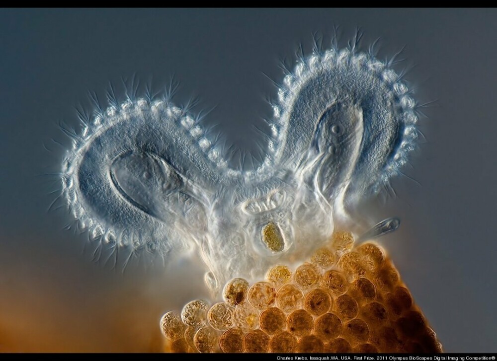 Viata uimitoare care se afla sub microscop. FOTOGRAFII ale unei lumi nevazute cu ochiul liber - Imaginea 3