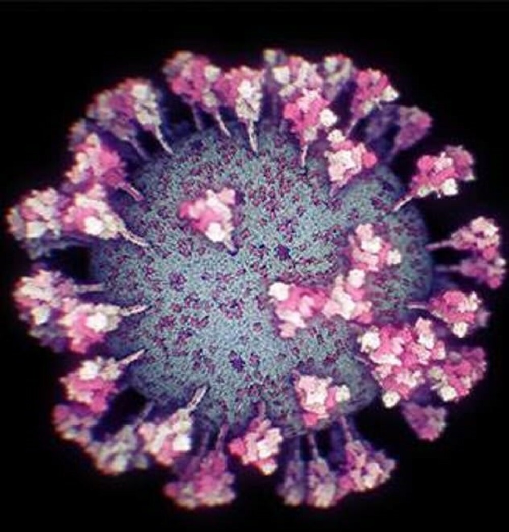 Cele mai noi imagini cu coronavirusul SARS-CoV-2 văzut la microscop. GALERIE FOTO - Imaginea 2