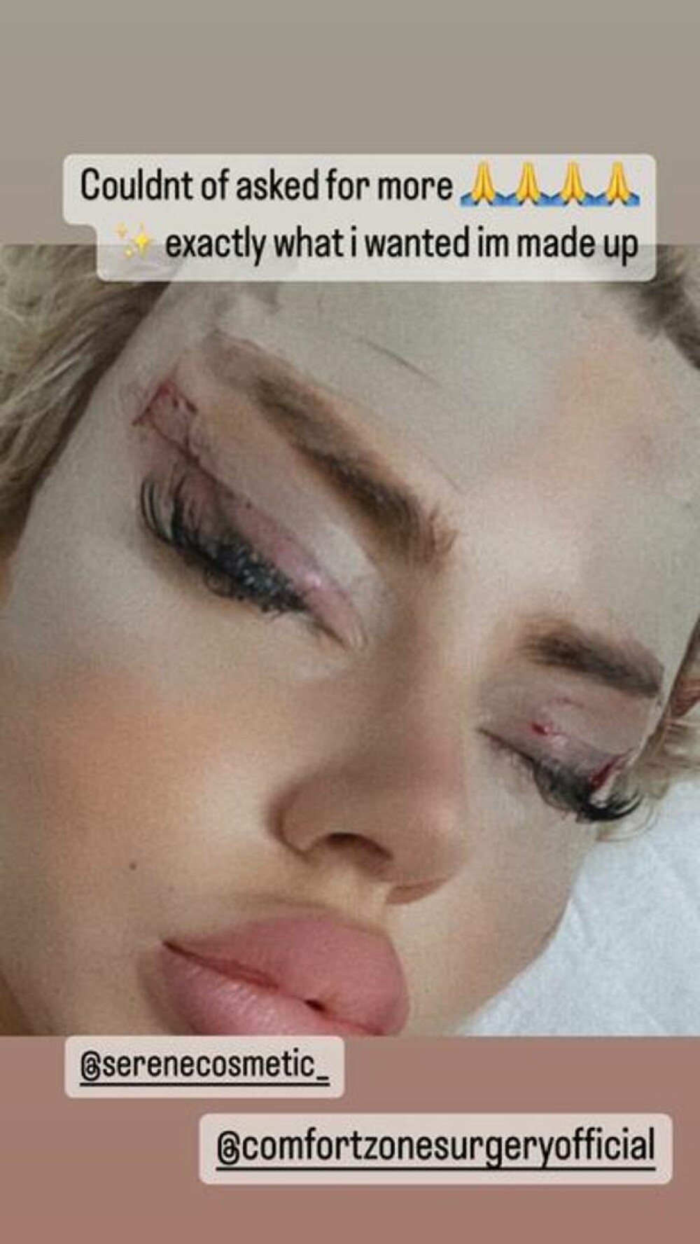 Cum arată o femeie după ce s-a operat estetic pentru a arăta ca păpușa Bratz | GALERIE FOTO - Imaginea 1