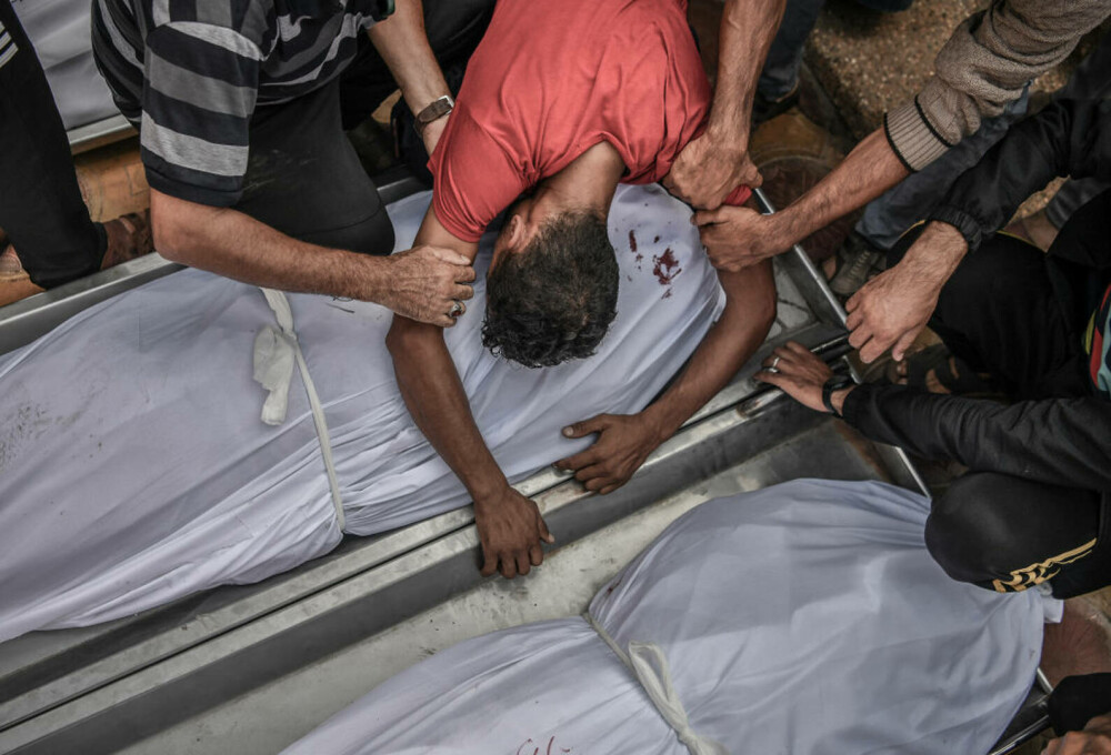 Oroare și durere: Imagini tragice din interiorul spitalelor din Gaza, unde pacienții sunt operați pe viu, fără anestezie FOTO - Imaginea 6