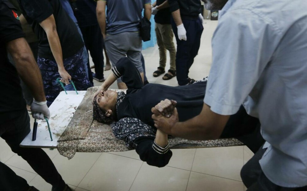 Oroare și durere: Imagini tragice din interiorul spitalelor din Gaza, unde pacienții sunt operați pe viu, fără anestezie FOTO - Imaginea 9