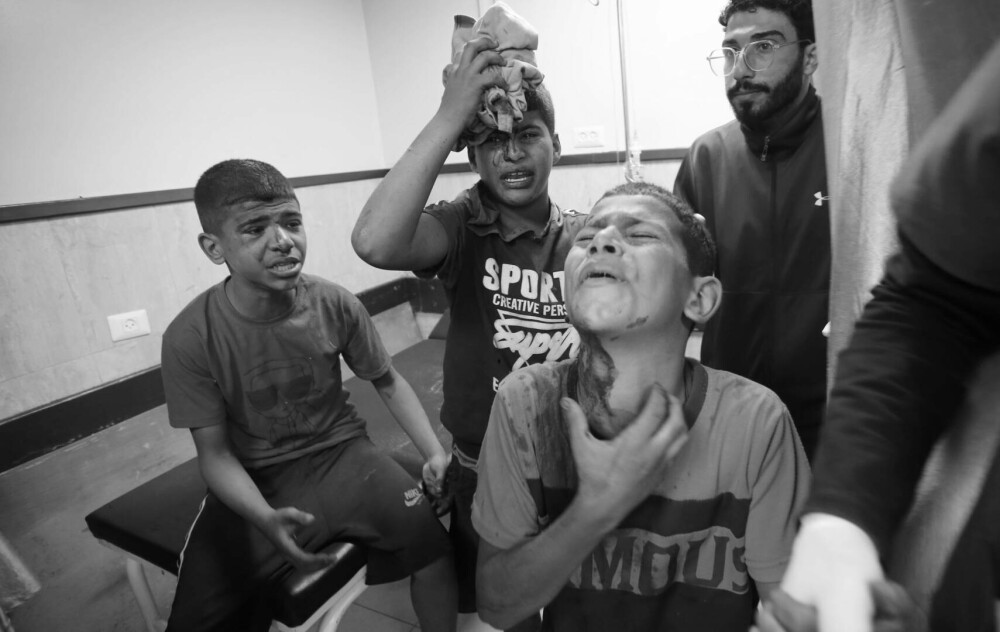 Oroare și durere: Imagini tragice din interiorul spitalelor din Gaza, unde pacienții sunt operați pe viu, fără anestezie FOTO - Imaginea 10