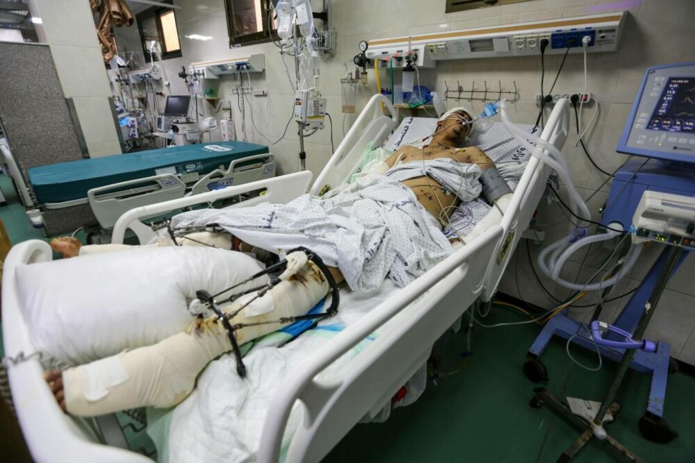 Oroare și durere: Imagini tragice din interiorul spitalelor din Gaza, unde pacienții sunt operați pe viu, fără anestezie FOTO - Imaginea 18