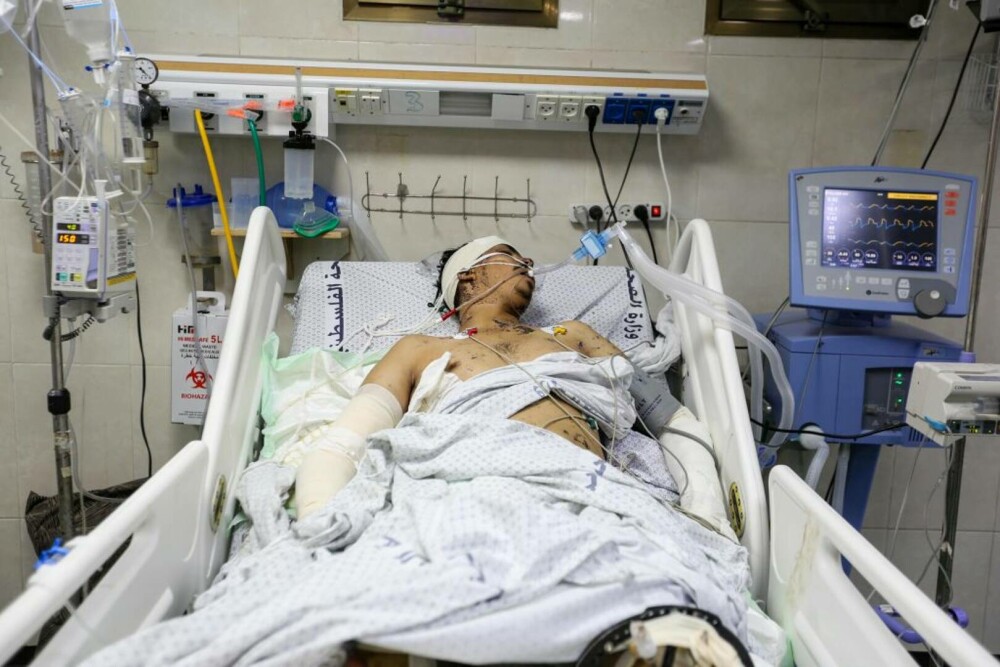 Oroare și durere: Imagini tragice din interiorul spitalelor din Gaza, unde pacienții sunt operați pe viu, fără anestezie FOTO - Imaginea 19