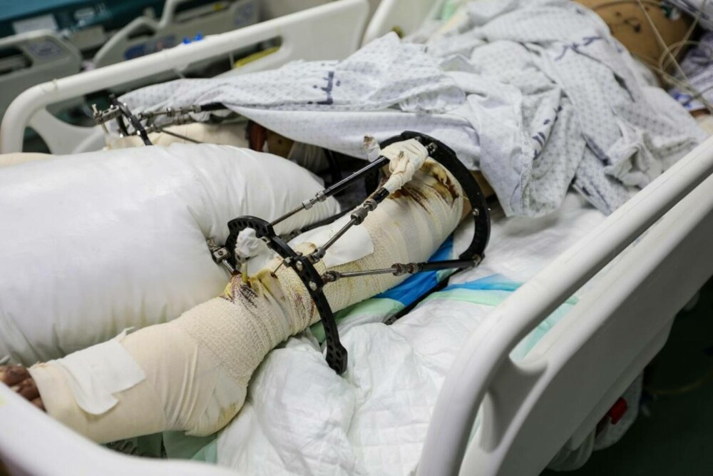 Oroare și durere: Imagini tragice din interiorul spitalelor din Gaza, unde pacienții sunt operați pe viu, fără anestezie FOTO - Imaginea 20