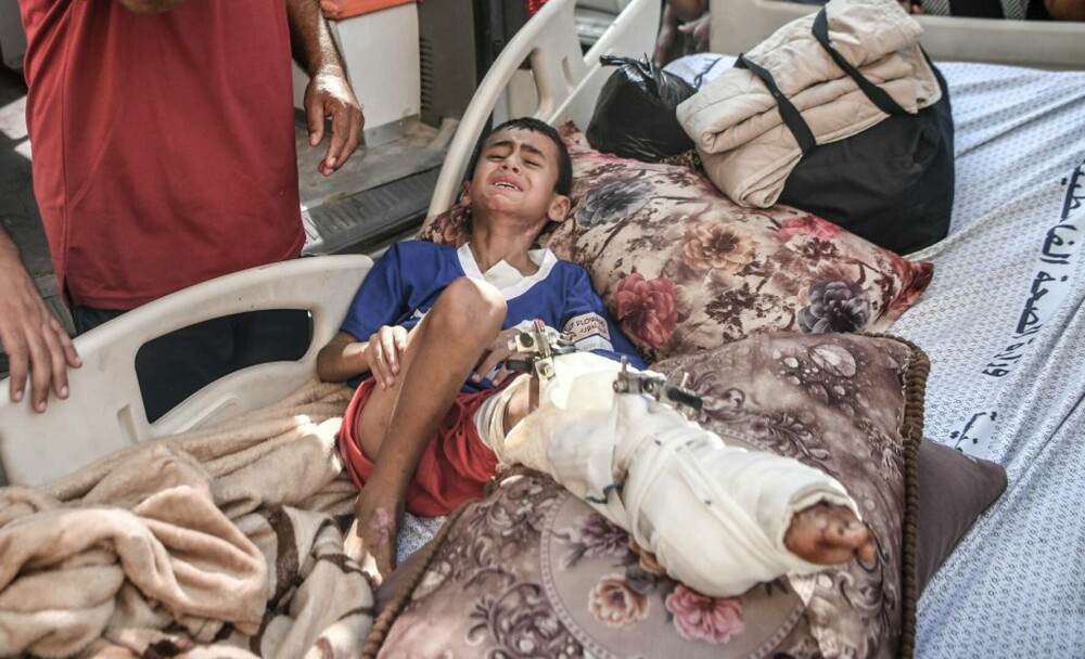 Oroare și durere: Imagini tragice din interiorul spitalelor din Gaza, unde pacienții sunt operați pe viu, fără anestezie FOTO - Imaginea 23