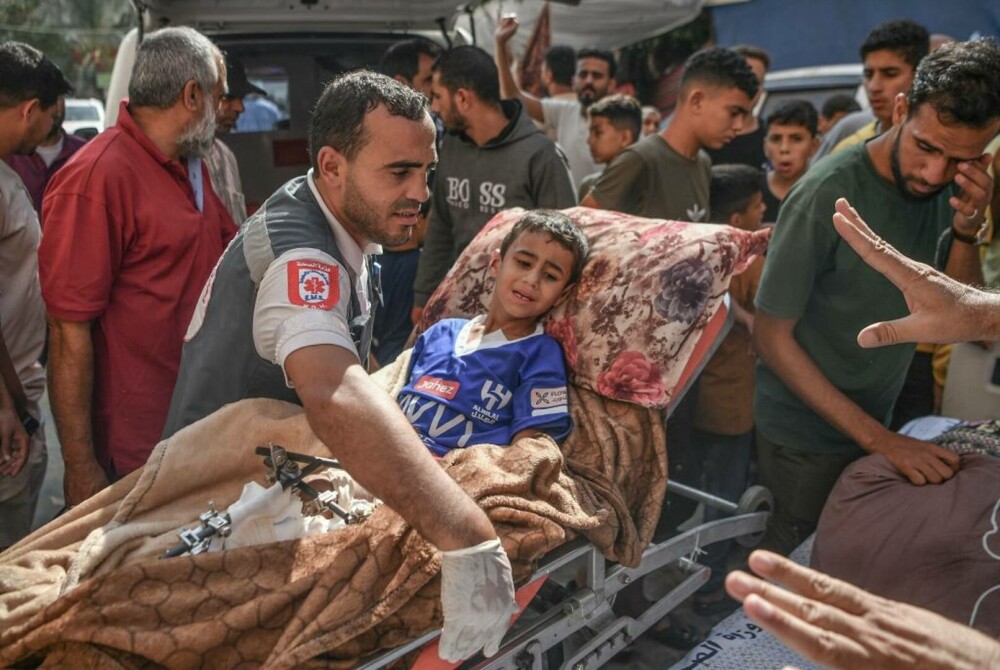 Oroare și durere: Imagini tragice din interiorul spitalelor din Gaza, unde pacienții sunt operați pe viu, fără anestezie FOTO - Imaginea 24