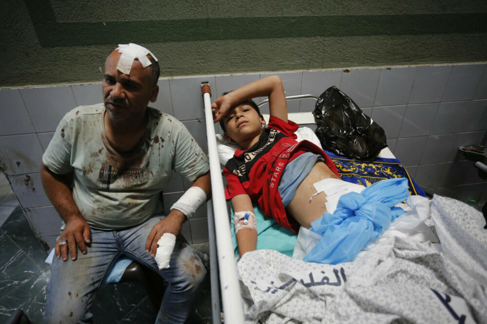 Oroare și durere: Imagini tragice din interiorul spitalelor din Gaza, unde pacienții sunt operați pe viu, fără anestezie FOTO - Imaginea 25