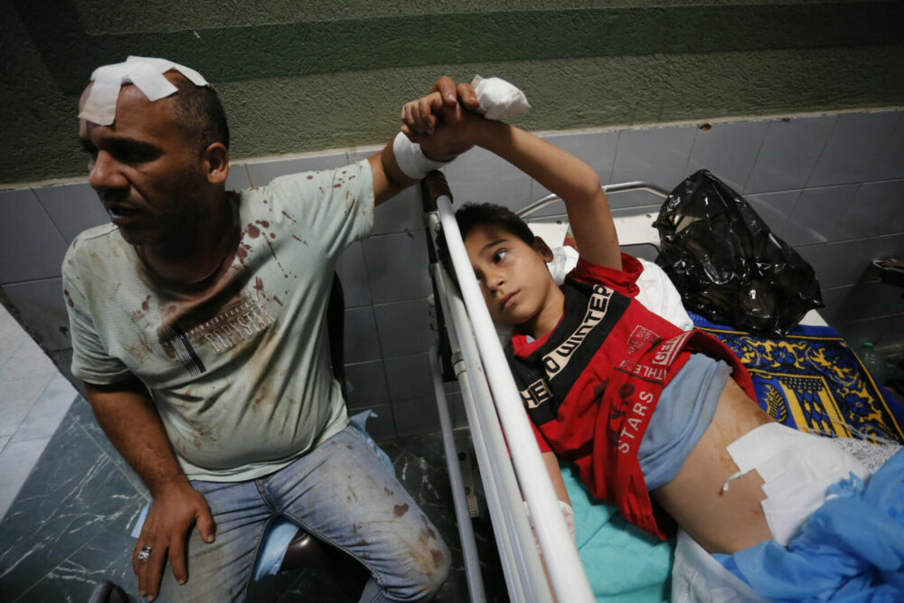 Oroare și durere: Imagini tragice din interiorul spitalelor din Gaza, unde pacienții sunt operați pe viu, fără anestezie FOTO - Imaginea 26