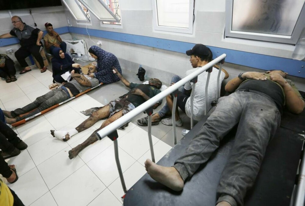 Oroare și durere: Imagini tragice din interiorul spitalelor din Gaza, unde pacienții sunt operați pe viu, fără anestezie FOTO - Imaginea 40
