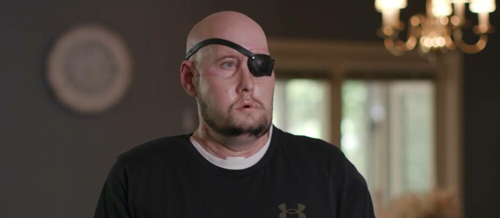 Cum arată bărbatul care a primit primul transplant de ochi. „A fost un sentiment nebunesc”. GALERIE FOTO - Imaginea 3