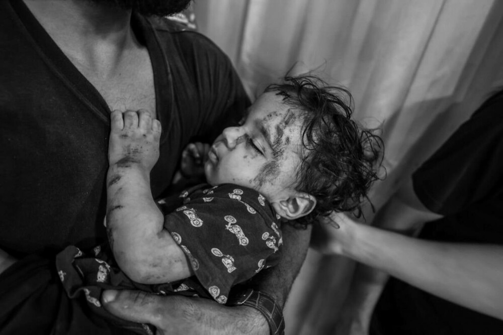 Medic din Gaza, despre realitatea cruntă a războiului: „Bebelușii sunt lăsați să moară în spitale. Se transformă în cimitire” - Imaginea 3