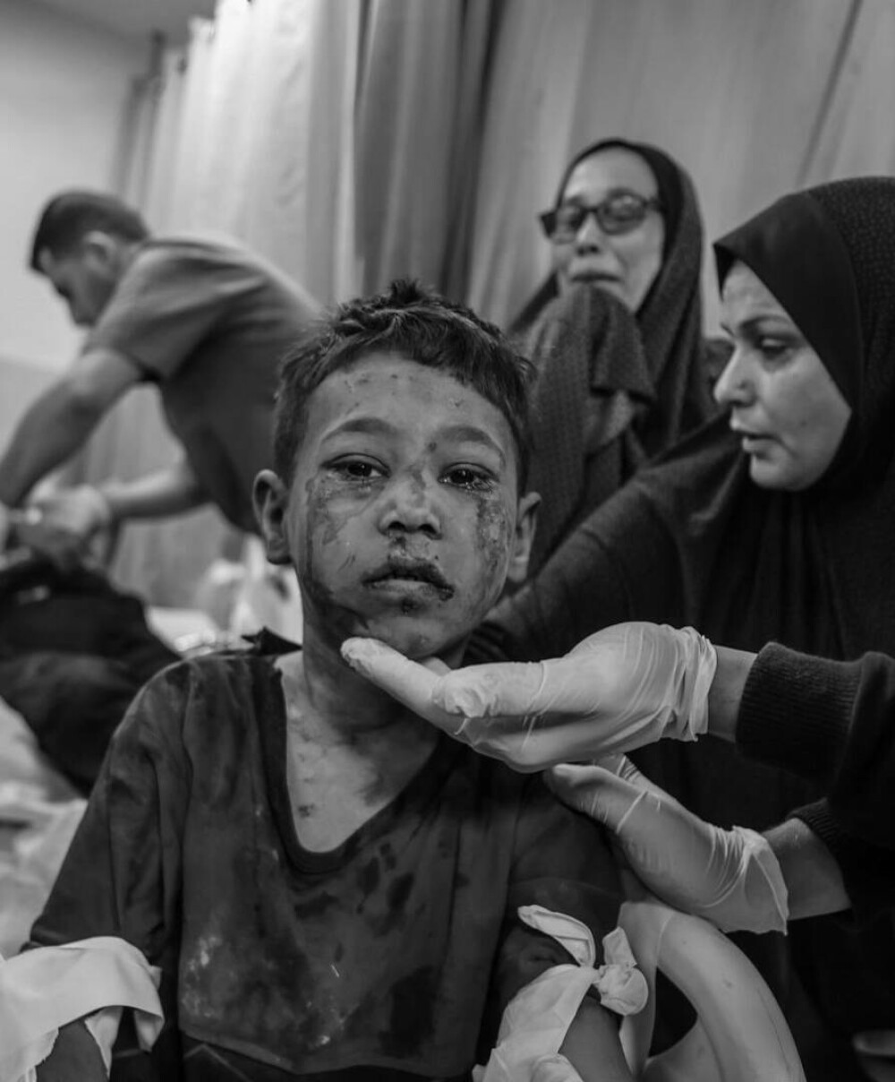 Medic din Gaza, despre realitatea cruntă a războiului: „Bebelușii sunt lăsați să moară în spitale. Se transformă în cimitire” - Imaginea 5