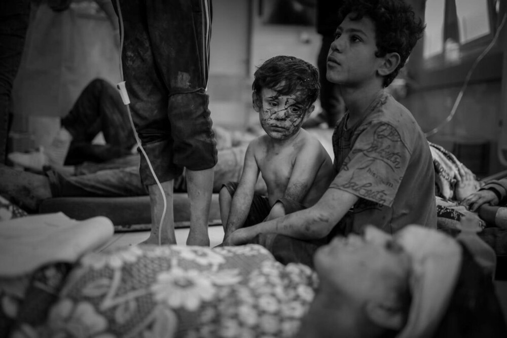 Medic din Gaza, despre realitatea cruntă a războiului: „Bebelușii sunt lăsați să moară în spitale. Se transformă în cimitire” - Imaginea 8