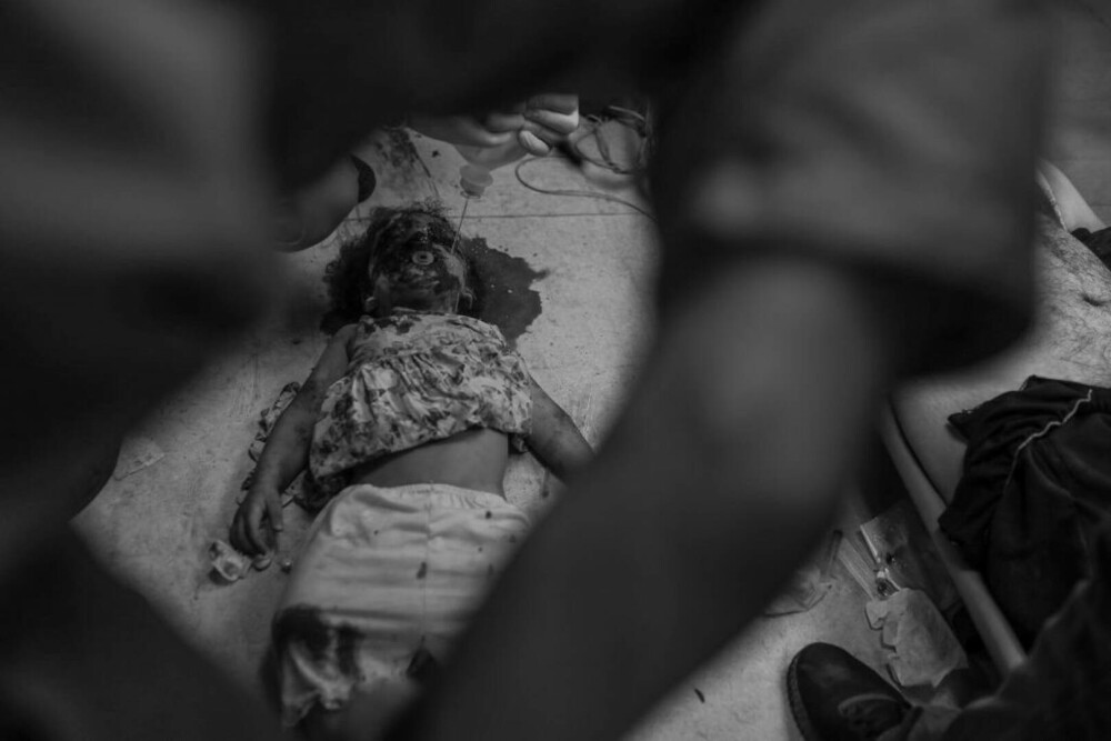 Medic din Gaza, despre realitatea cruntă a războiului: „Bebelușii sunt lăsați să moară în spitale. Se transformă în cimitire” - Imaginea 9
