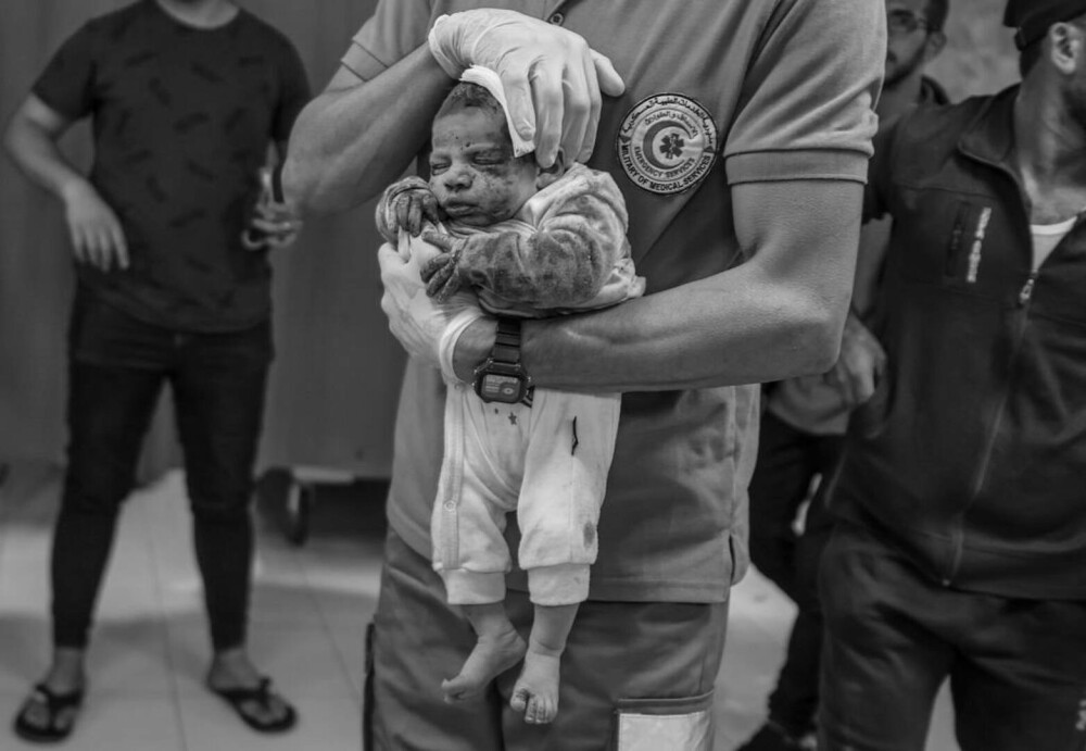 Medic din Gaza, despre realitatea cruntă a războiului: „Bebelușii sunt lăsați să moară în spitale. Se transformă în cimitire” - Imaginea 11