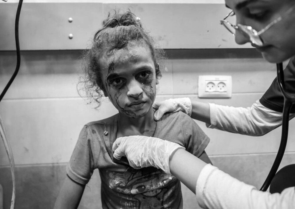 Medic din Gaza, despre realitatea cruntă a războiului: „Bebelușii sunt lăsați să moară în spitale. Se transformă în cimitire” - Imaginea 14