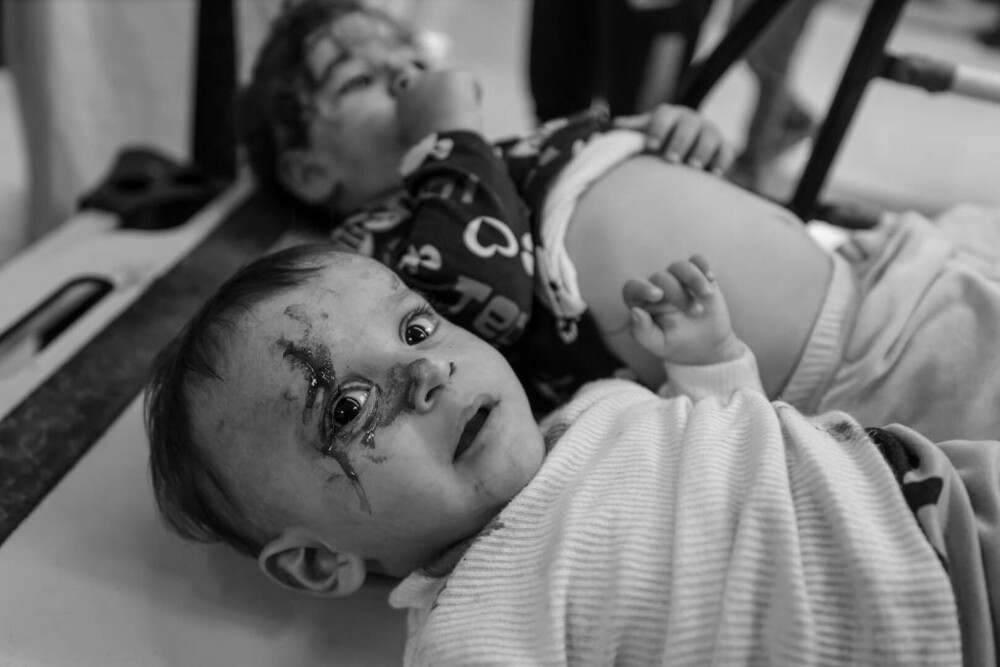 Medic din Gaza, despre realitatea cruntă a războiului: „Bebelușii sunt lăsați să moară în spitale. Se transformă în cimitire” - Imaginea 15