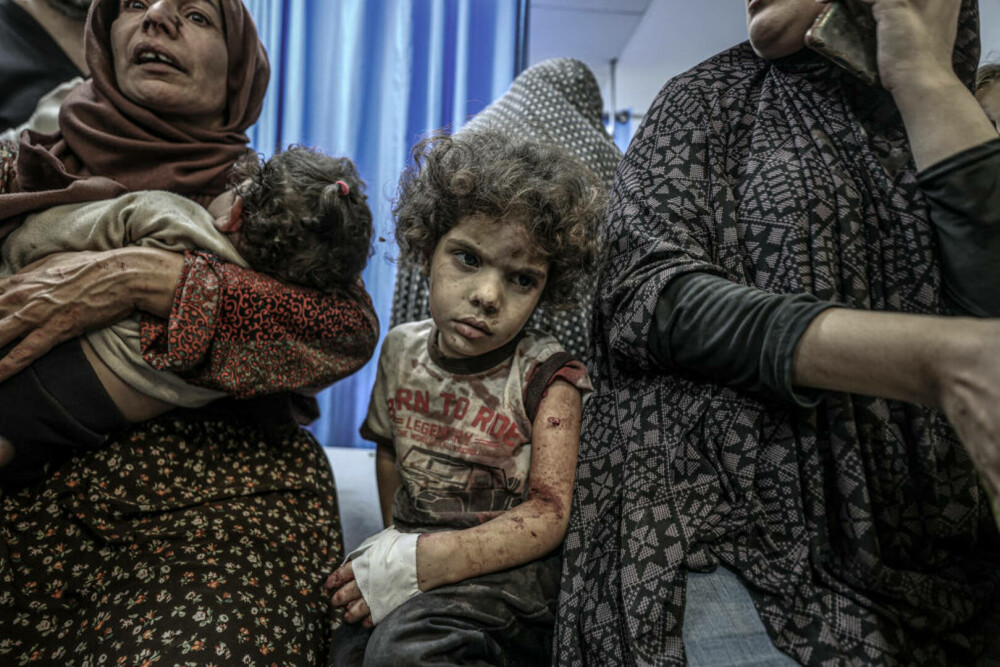 Medic din Gaza, despre realitatea cruntă a războiului: „Bebelușii sunt lăsați să moară în spitale. Se transformă în cimitire” - Imaginea 20