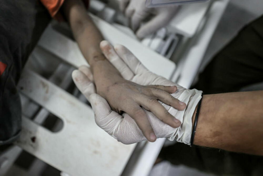 Medic din Gaza, despre realitatea cruntă a războiului: „Bebelușii sunt lăsați să moară în spitale. Se transformă în cimitire” - Imaginea 24
