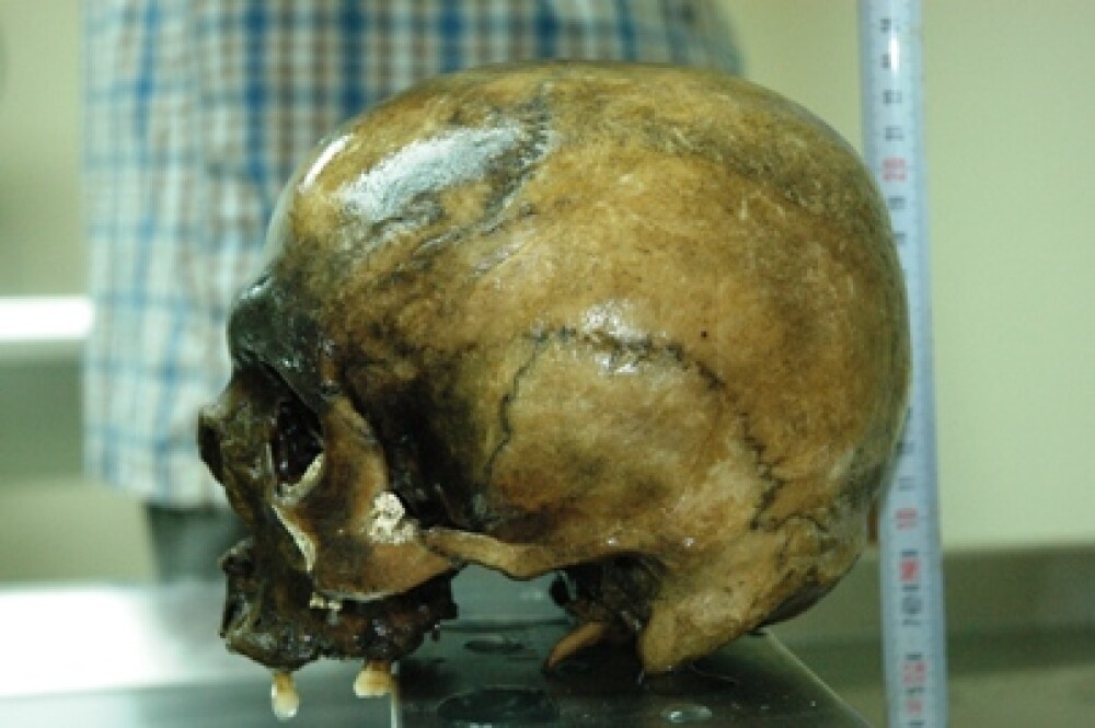 Craniu descoperit la Covasna - anchetatorii cred ca e al Elodiei. FOTO - Imaginea 1