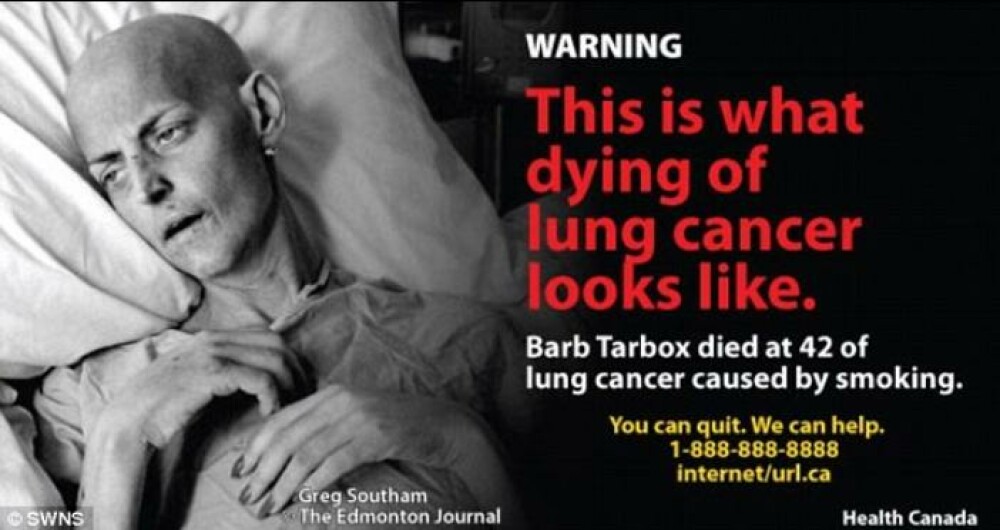 Cea mai socanta campanie anti-fumat. Bolnavi de cancer pe patul de moarte, pe pachetele de tigari - Imaginea 1