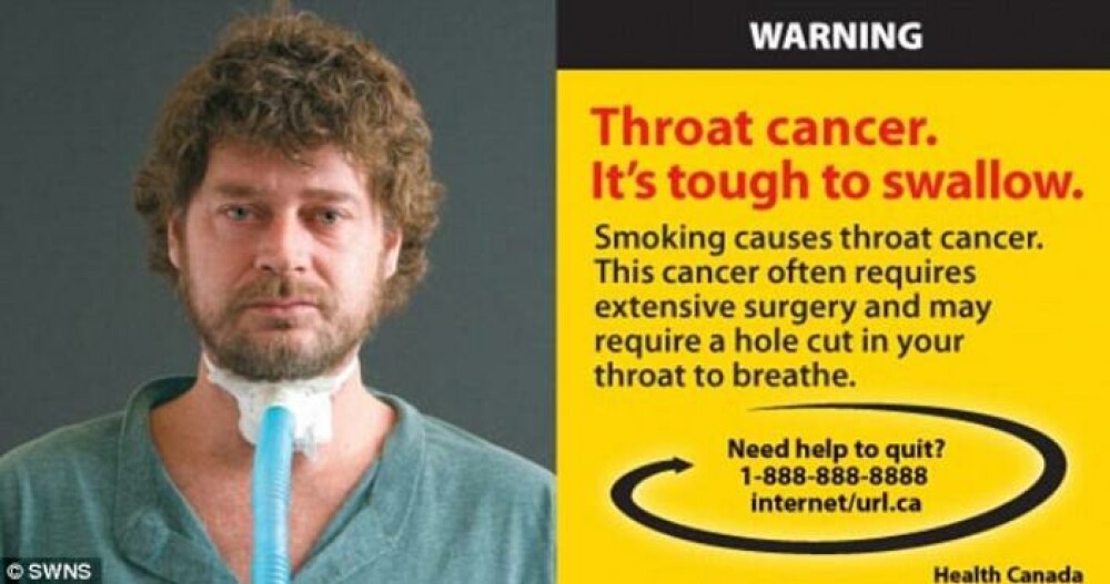 Cea mai socanta campanie anti-fumat. Bolnavi de cancer pe patul de moarte, pe pachetele de tigari - Imaginea 2