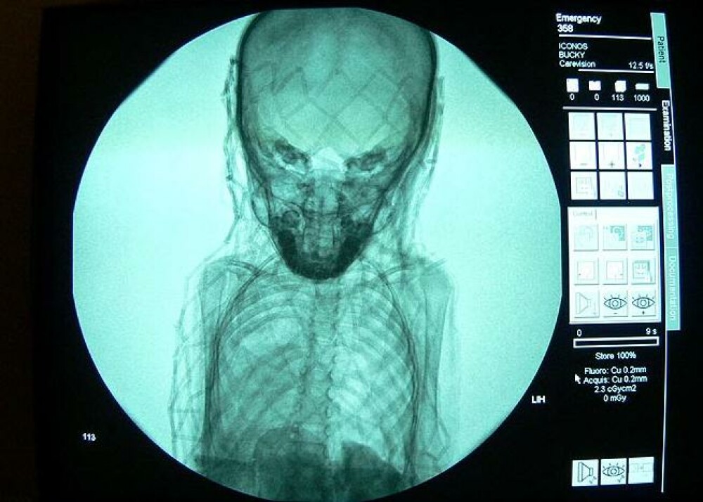 Mister vechi de aproape 3.500 de ani, dezlegat cu ajutorul unei radiografii. FOTO - Imaginea 2