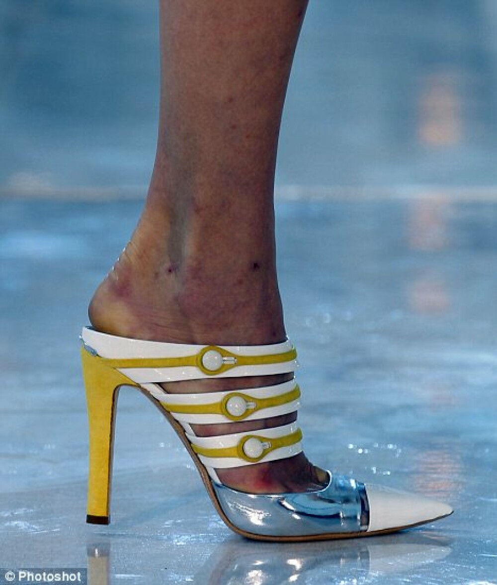 Marturie FOTO: picioarele chinuite ale modelelor care isi sacrifica frumusetea la prezentari - Imaginea 1