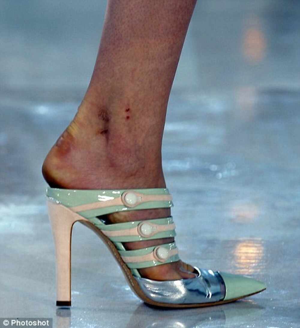 Marturie FOTO: picioarele chinuite ale modelelor care isi sacrifica frumusetea la prezentari - Imaginea 2