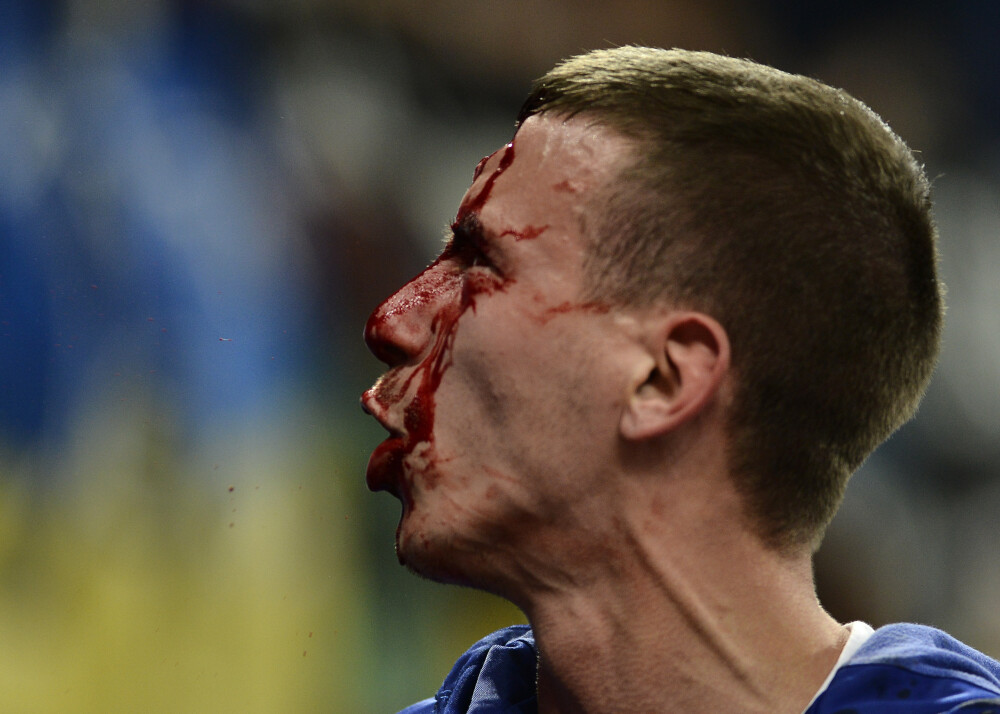 Violente in tribunele National Arena la meciul Romania - Ungaria. 46 de spectatori, printre care si copii, au ajuns la spital - Imaginea 8
