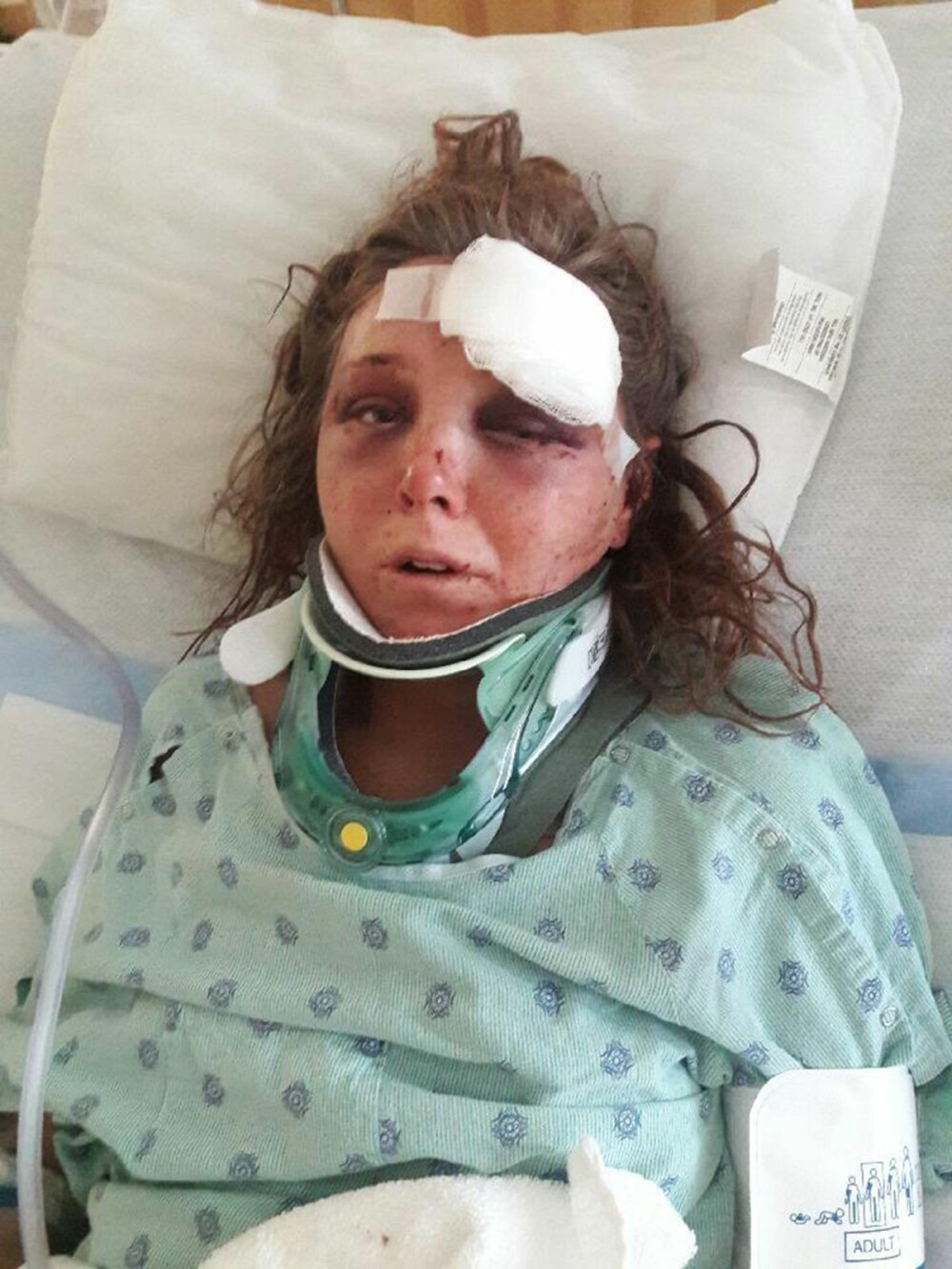 Parea sa aiba viata perfecta in pozele de pe Facebook, dar a ajuns la spital cu limba smulsa de iubitul ei. Cum arata tanara - Imaginea 2