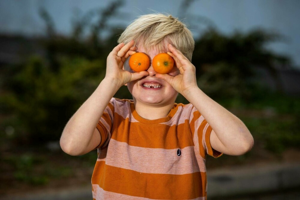 „Fiul meu a devenit galben, după ce a mâncat prea multe portocale”. Cum arată copilul. GALERIE FOTO - Imaginea 1