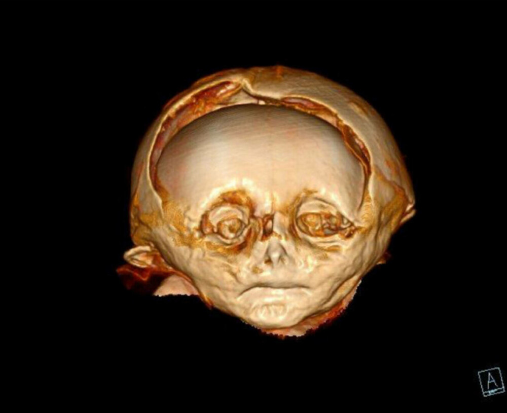 A fost descoperit misterul băiatului mumificat, la 400 de ani de la moartea lui. Cine era de fapt GALERIE FOTO - Imaginea 5