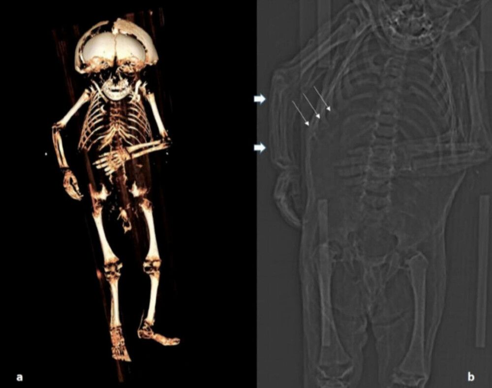 A fost descoperit misterul băiatului mumificat, la 400 de ani de la moartea lui. Cine era de fapt GALERIE FOTO - Imaginea 3
