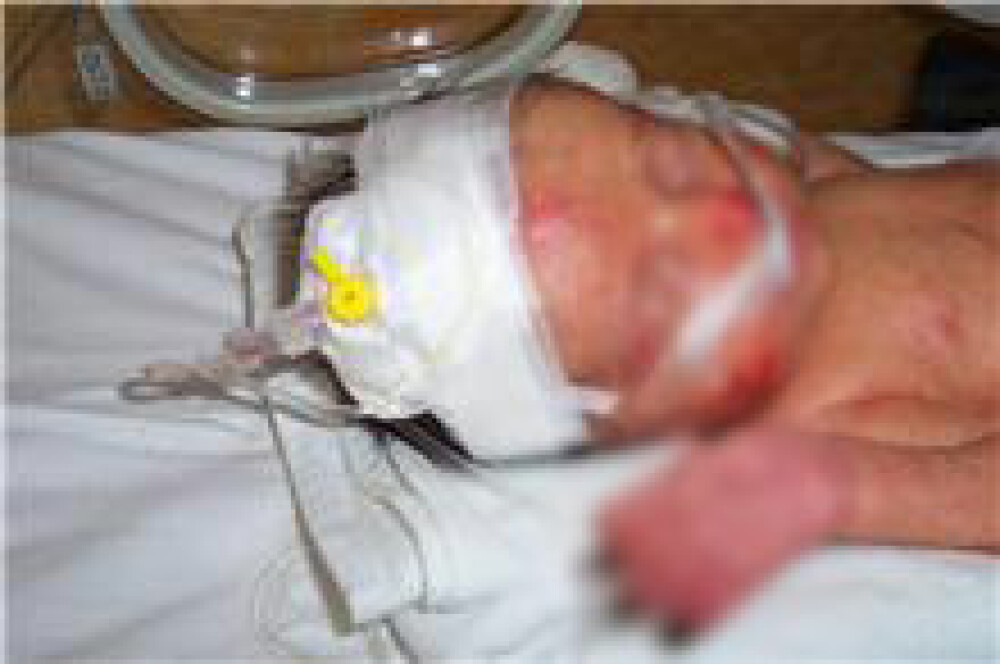 Imagini cu bebelusii raniti la Maternitatea Giulesti si externati miercuri - Imaginea 1