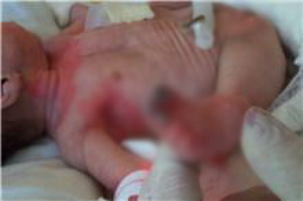Imagini cu bebelusii raniti la Maternitatea Giulesti si externati miercuri - Imaginea 2