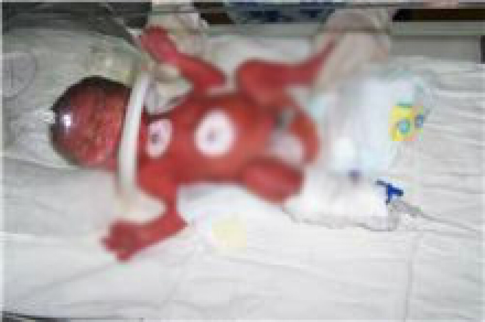 Imagini cu bebelusii raniti la Maternitatea Giulesti si externati miercuri - Imaginea 3