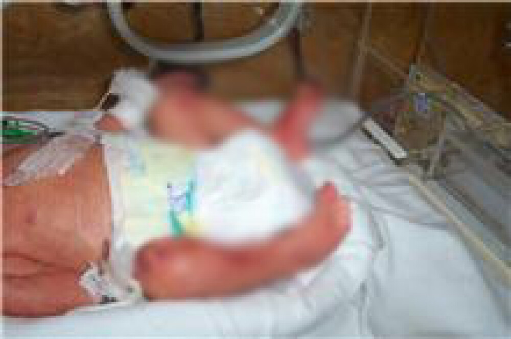 Imagini cu bebelusii raniti la Maternitatea Giulesti si externati miercuri - Imaginea 5
