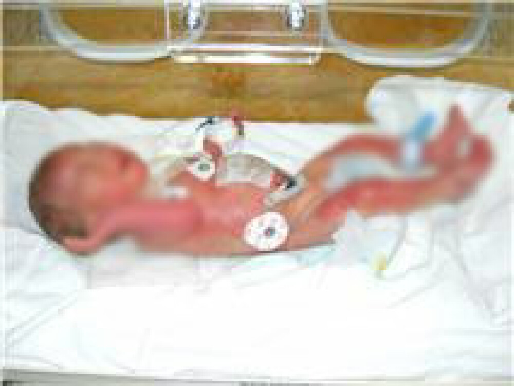 Imagini cu bebelusii raniti la Maternitatea Giulesti si externati miercuri - Imaginea 6