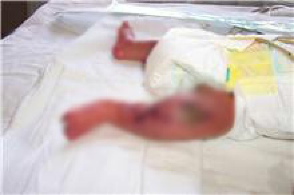 Imagini cu bebelusii raniti la Maternitatea Giulesti si externati miercuri - Imaginea 7