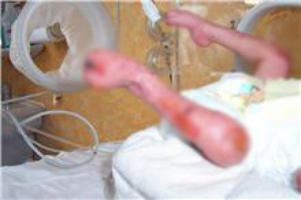 Imagini cu bebelusii raniti la Maternitatea Giulesti si externati miercuri - Imaginea 9