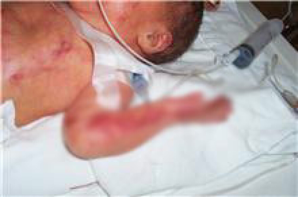 Imagini cu bebelusii raniti la Maternitatea Giulesti si externati miercuri - Imaginea 10
