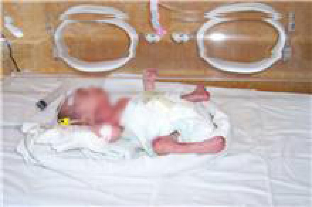 Imagini cu bebelusii raniti la Maternitatea Giulesti si externati miercuri - Imaginea 11