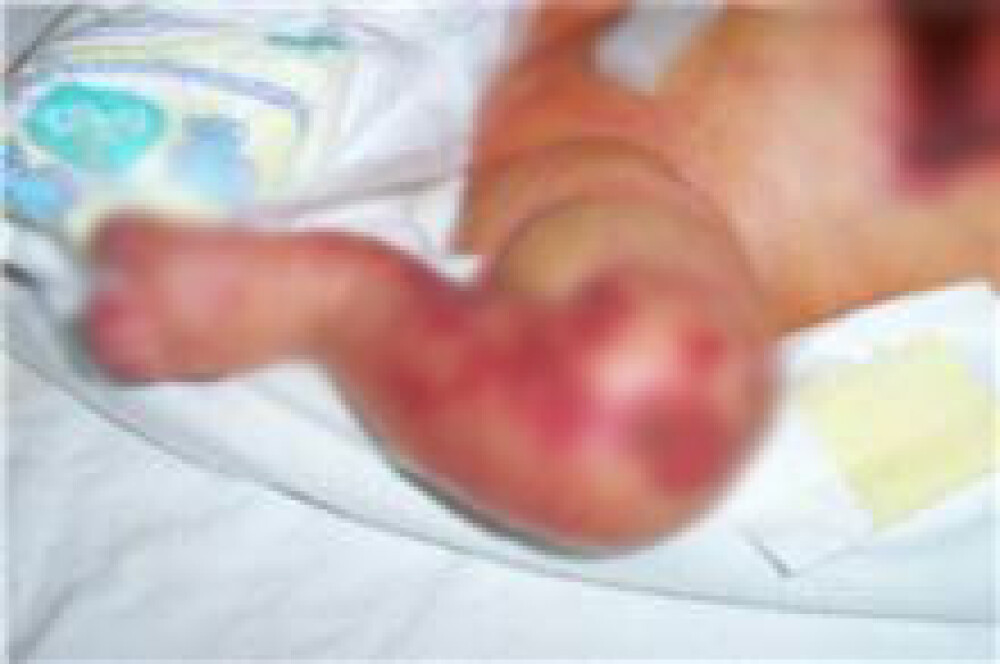 Imagini cu bebelusii raniti la Maternitatea Giulesti si externati miercuri - Imaginea 13
