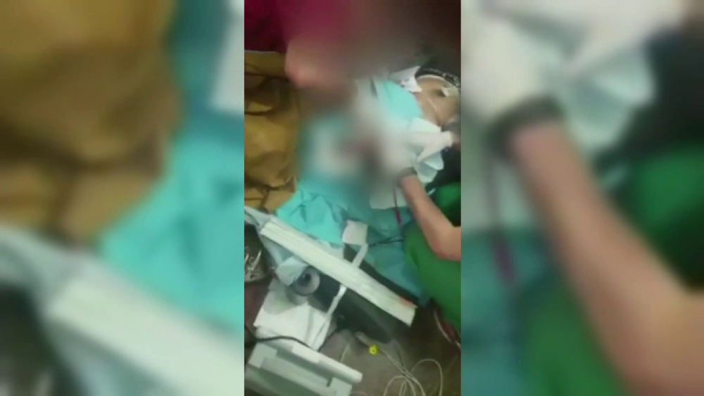 Copii raniti de bombe operati direct pe podea in spitalele din Alep. Semnalul de alarma tras de comunitatea internationala. - Imaginea 2