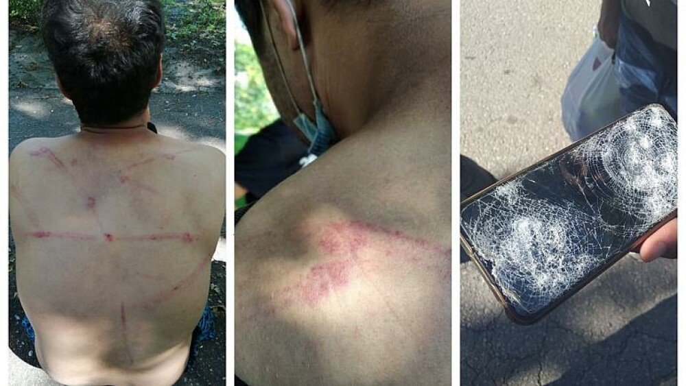 Mai mulți refugiați acuză polițiștii de frontieră din România că îi bat cu biciul și îi electrocutează - Imaginea 2